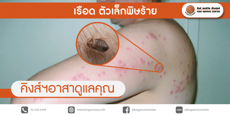 เรือด ตัวเล็กพิษร้าย